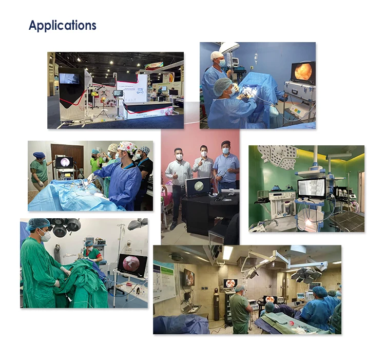 IKEDA 22 inch Portable Endoscope Camera with Recording for Arthroscopy surgery