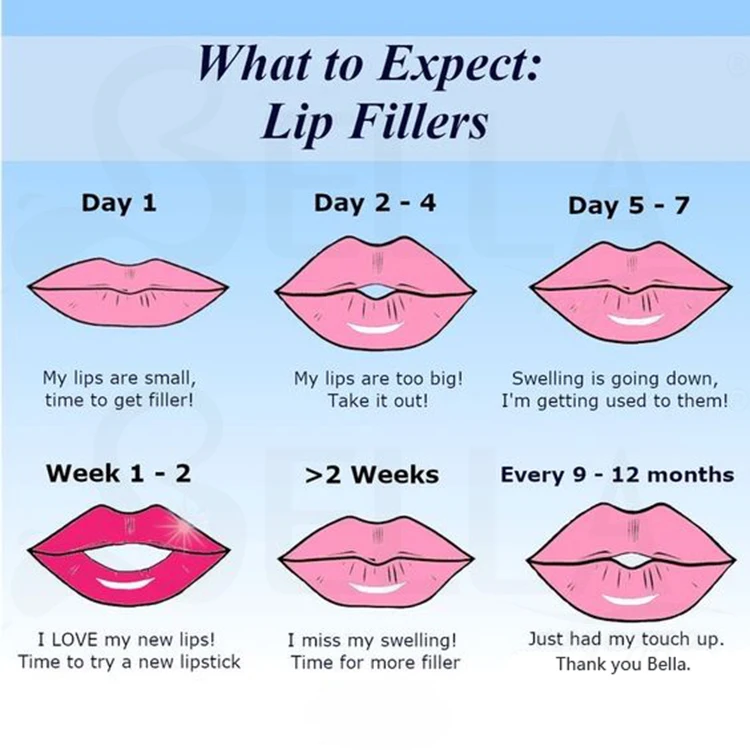 Lips