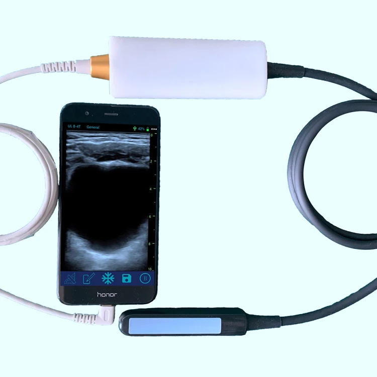 Ультразвуковая машина для прямотального проба крупного рогатого скота линейный прямотальный ветеринарный зонд ветеринарная ультразвуковая с прямотальным зондом