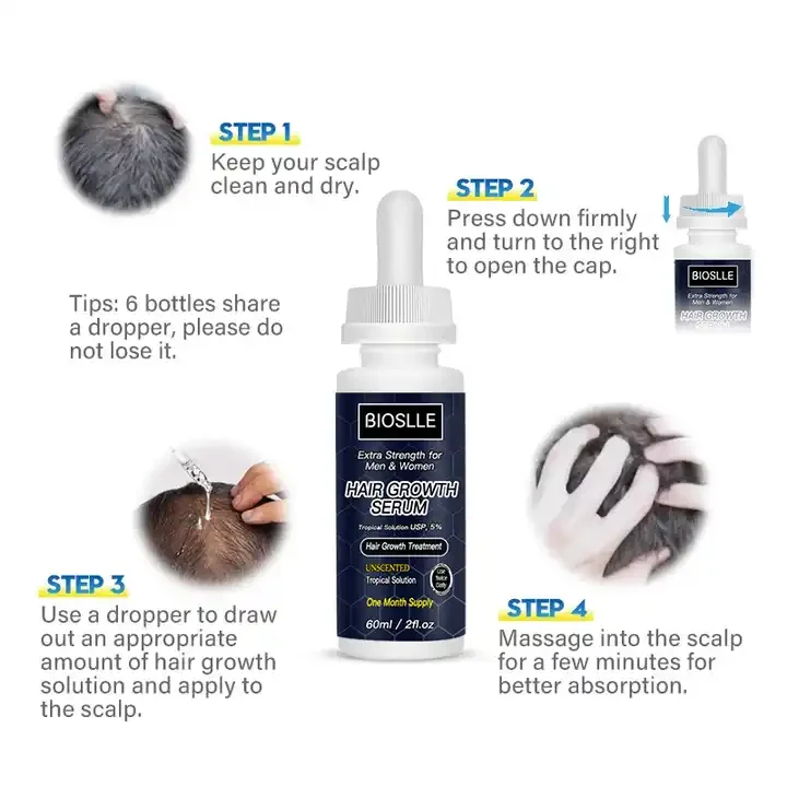 Private Label Hair Care Treatment Growth Oil Agent Prevents Hair Loss Nourishing Growth Serum Fast Hair Regrowth Tonic