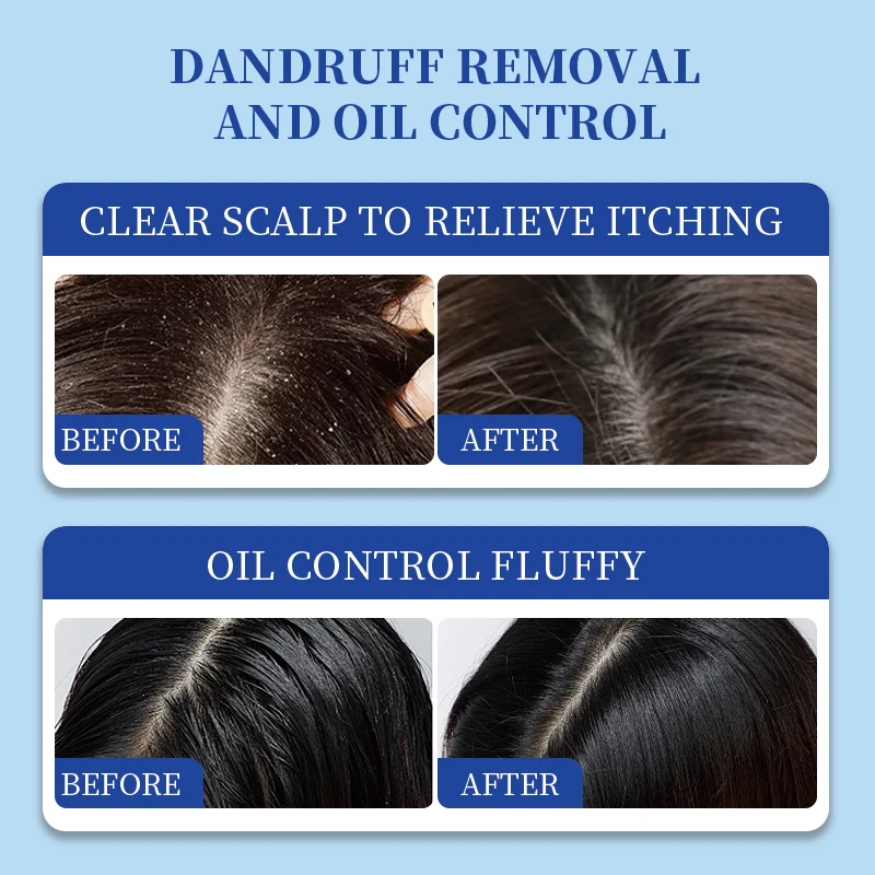 Containing Selenium Sulfide 1% Mint Professional Anti-Dandruff Shampoo Severe Dandruff Cleansing Shampoo Factory Wholesale