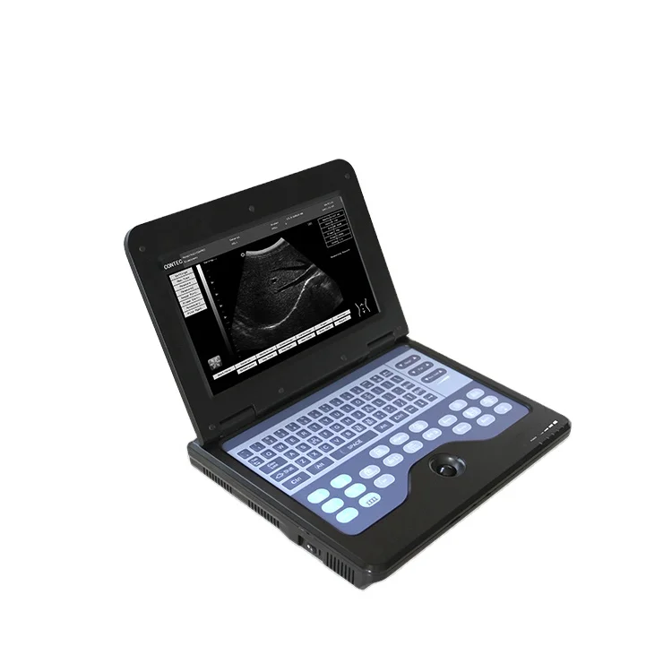 CONTEC CMS600P2 b ultrasound machine by qinhuangdao contec medical