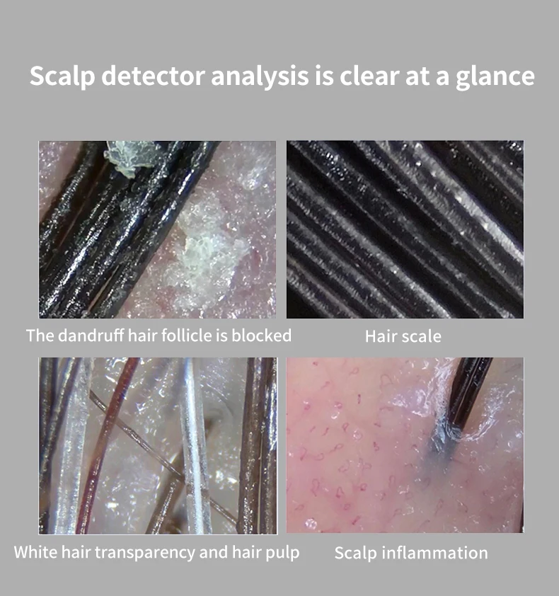 Skin Analyzer Scalp Hair Camera Scanner Wireless WiFi Connection Compatible with Android Ios System