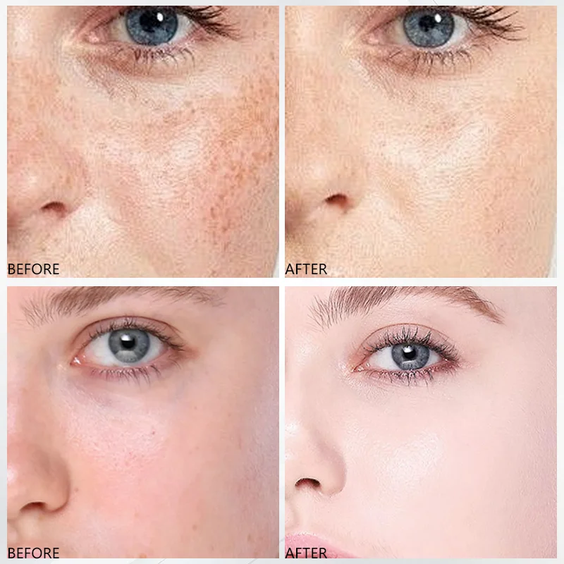 Custom 30ml Arbutin Niacinamide Turmeric Face Serum Brightening Vitamin C Hyaluronic Acid Skin Care Serum Facial