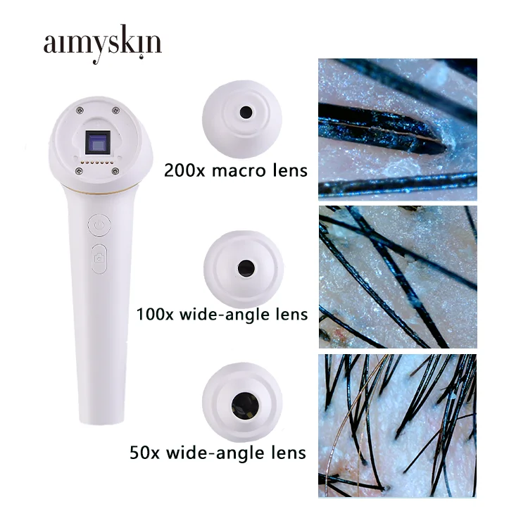 Scalp Hair Follicles Scanner Detector Hair Analyzer Skin And Scalp Hair Analysis Machine