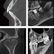 Hospital Dental Equipment Intelligent 3D CBCT Panoramic Imaging Machine Dental X-ray Machine