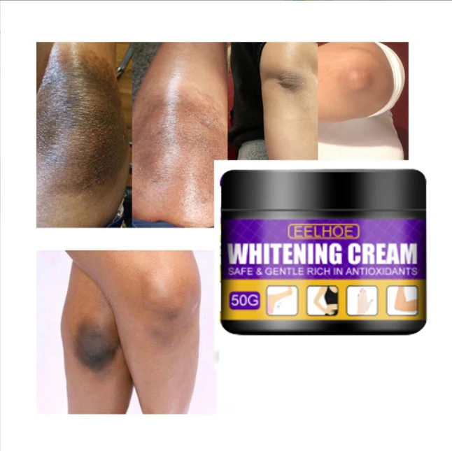 Высококачественный отбеливающий крем с темными коленями и локтями