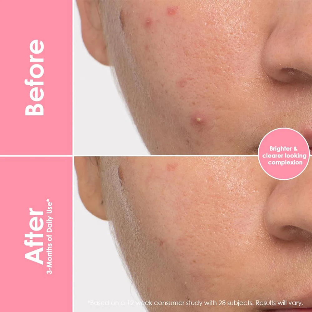 Private Label Support Skin Health Natural Citrus Flavor Vegan Gummy Supplement Collagen Gummies