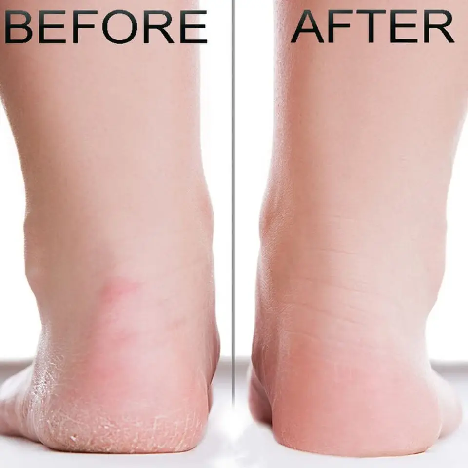 Private Label Natural Organic Spa Athletes Feet Treatment Softening Exfoliating Peppermint Foot Scrub For Cracked Feet