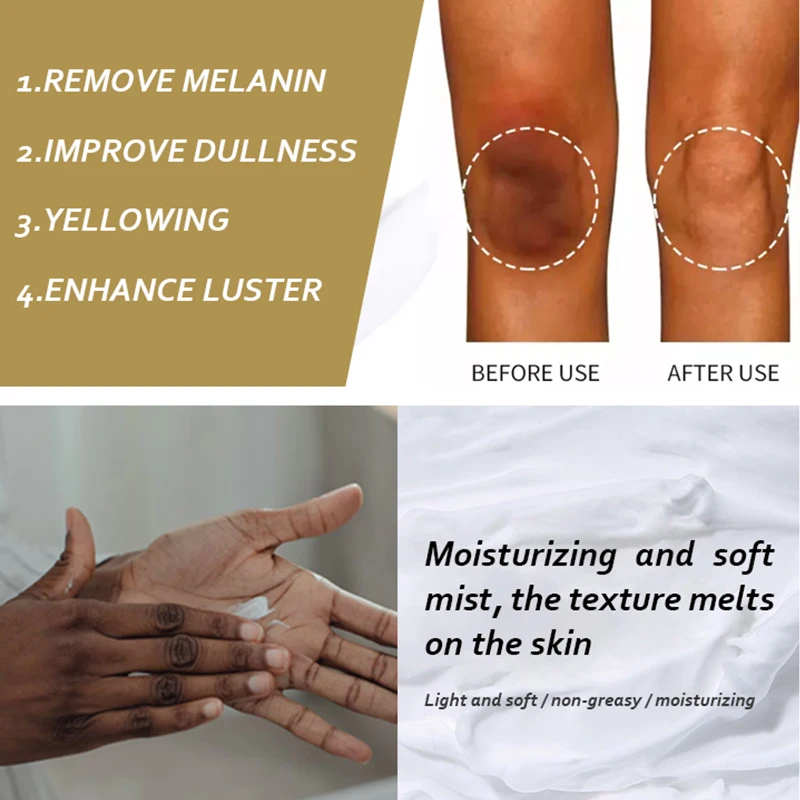 5D gluta Dark Knees and Elbows Strong Underarm Whitening Cream Armpit Fast Action Extreme Whitening Cream