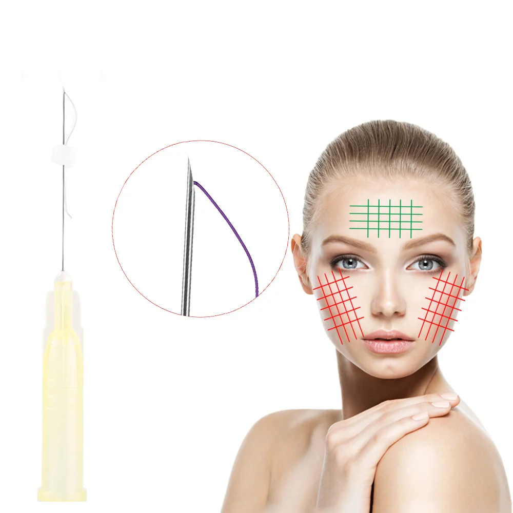 Beauty Clinic 30g 25mm Face Filling Hilos Type B Fios De Pdo Lift Mono Thread