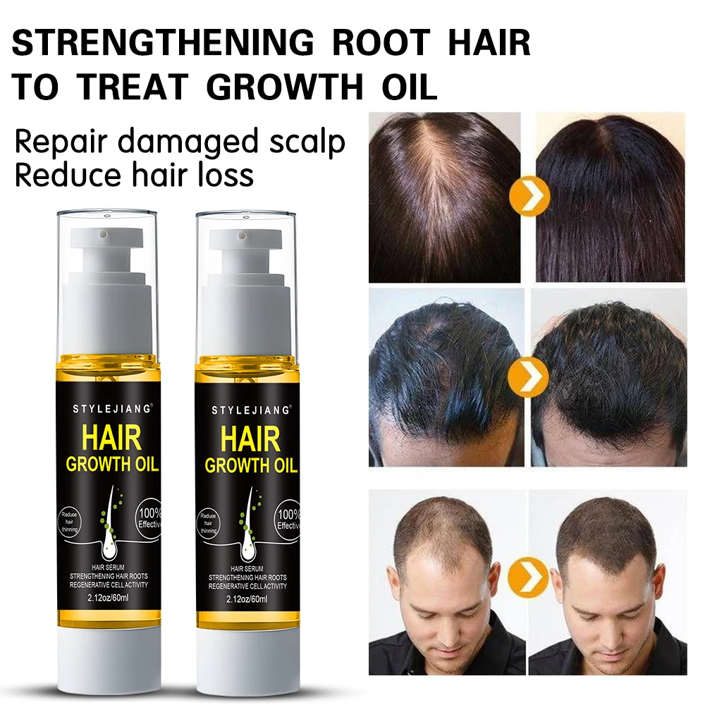 Factory OEM&ODM Anti-dandruff Moisturizing Hair Growth Oil for Men Hair Growth Oil Hair Scalp Care Products