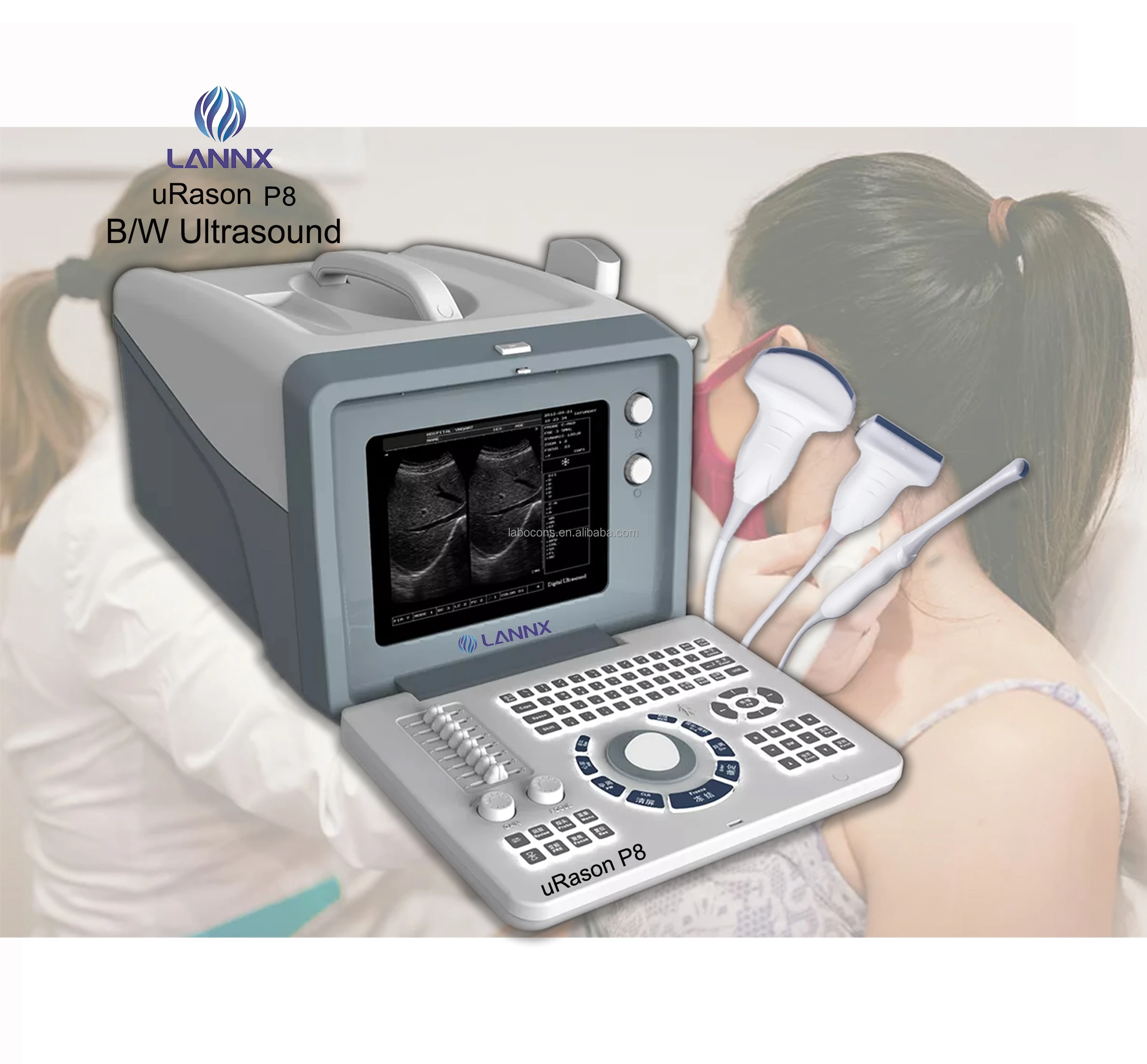 LANNX uRason P8 Newest Product Ultrasound Machine 3D image portable ultrasound examination scanner Echocardiography