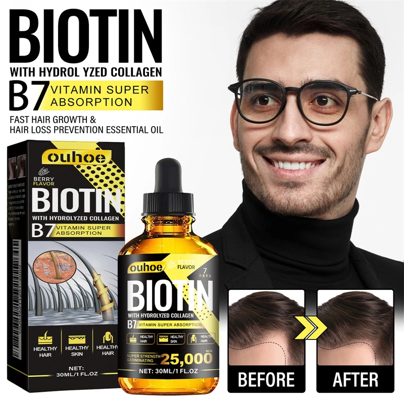 OUHOE 30ml collagen vitamin B7 dense hair essential oil scalp moisturizing growth promoting biotin hair growth oil for hair care