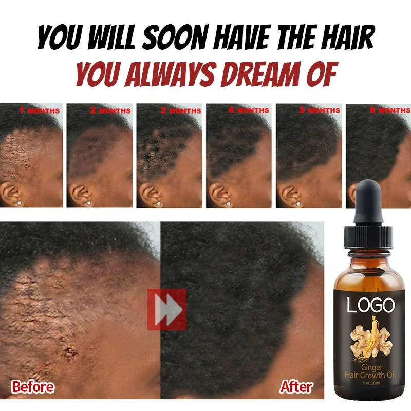 OEM Custom Private Label Hair Treatment Smooth Repair Hair Loss Thicker Ginger Hair Growth Oil Serum