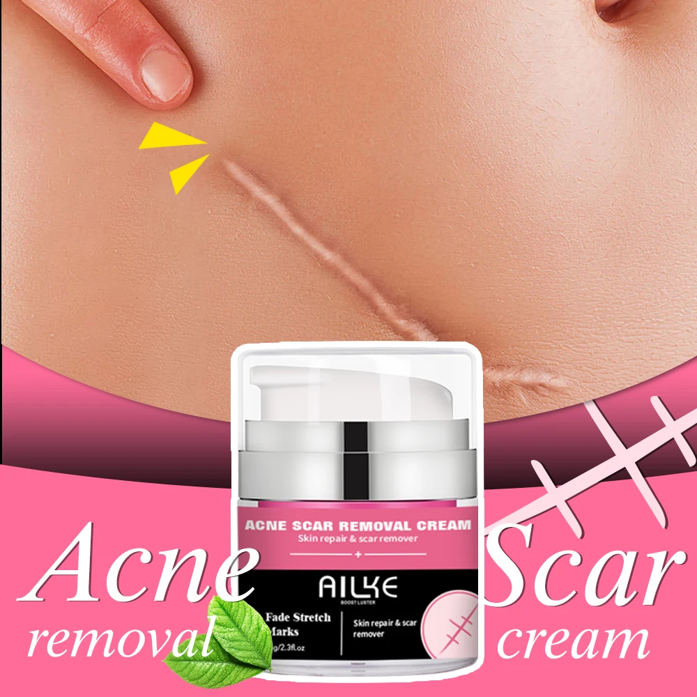 AILKE Skin Care Burn Scar Removal Repair Gel Face Pimples Acne Scar Mark Removal Cream For Old Scars On Legs