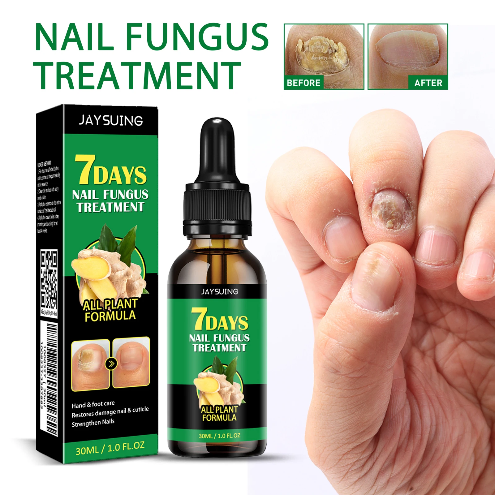 Hot Selling Wholesale Foot Care Cuticle Strengthen Nails Remove Onychomycosis 7 Days Fungal Nail Theatment Repairing Serum