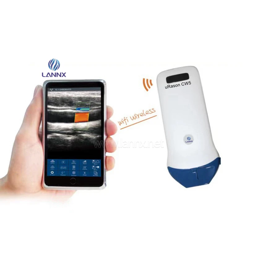 LANNX uRason CW5 Hot sale Wifi wireless Mobile ultrasound machines linear array probe color doppler Ultrasonic probe scanner