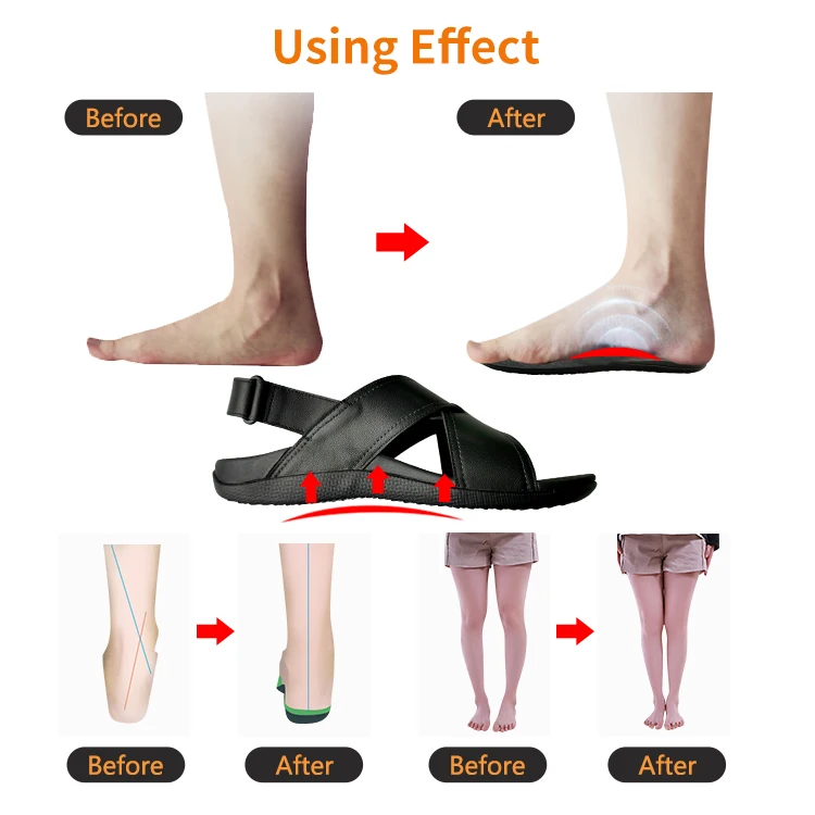 orthopedic non sandals sexy sandals for flat feet orthopedic bunion