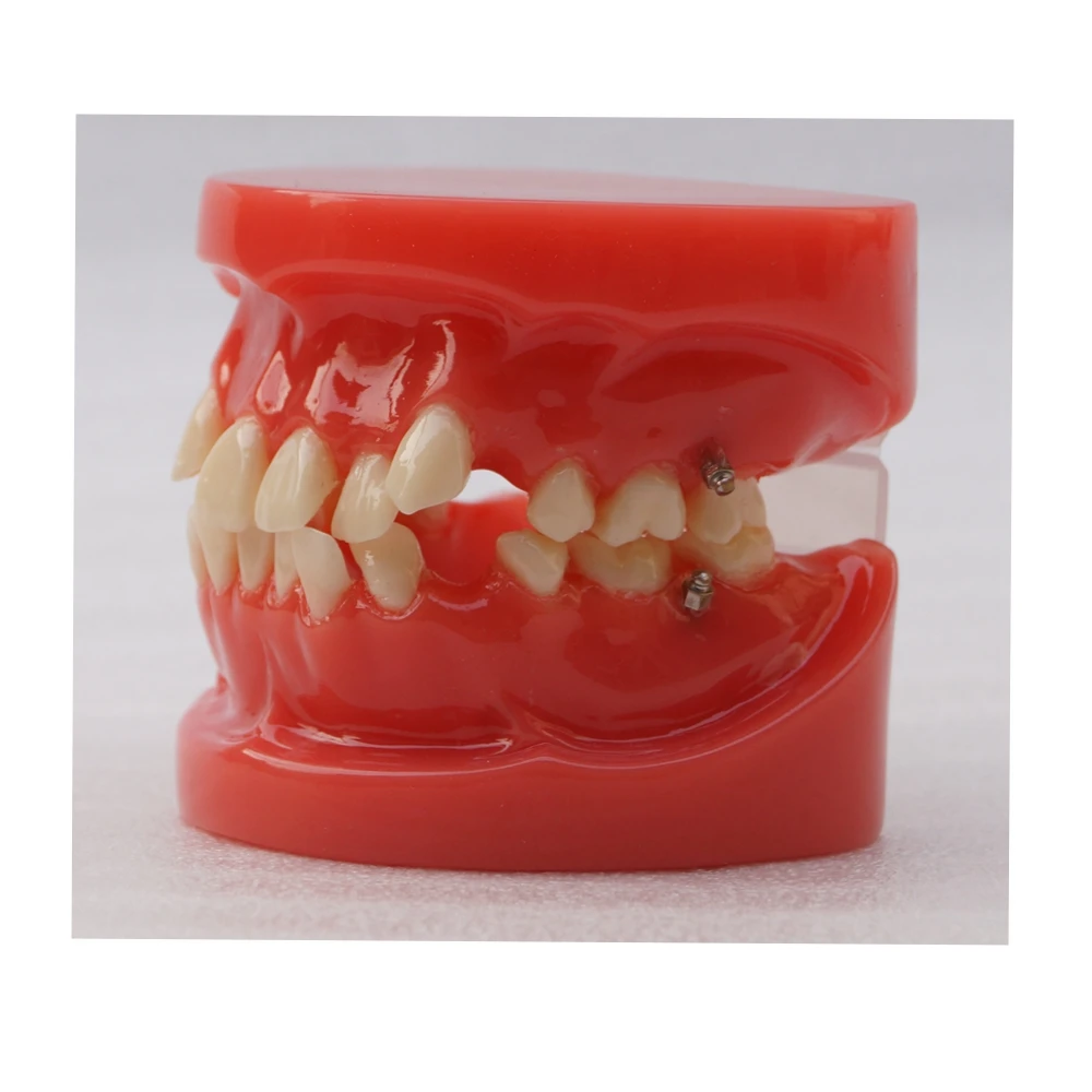 Dental Orthodontic Teeth Study Model Typodont Teeth Model 24Teeth