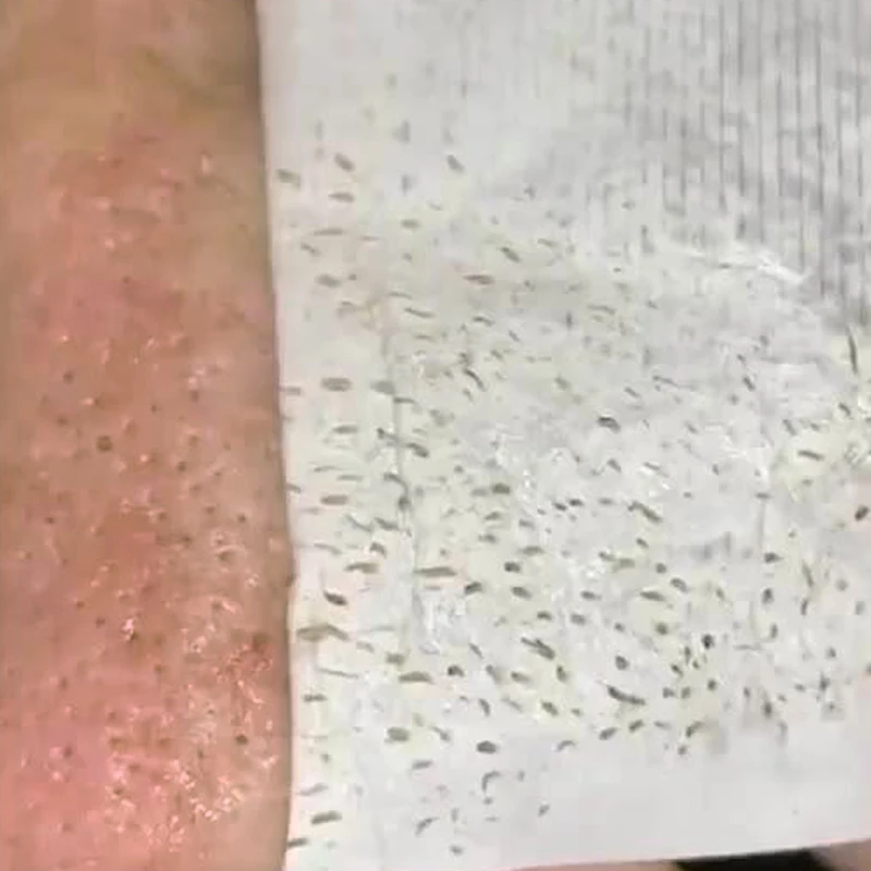 nose blackhead remover nasal membrane black Bamboo Charcoal paper sticker OEM ODM