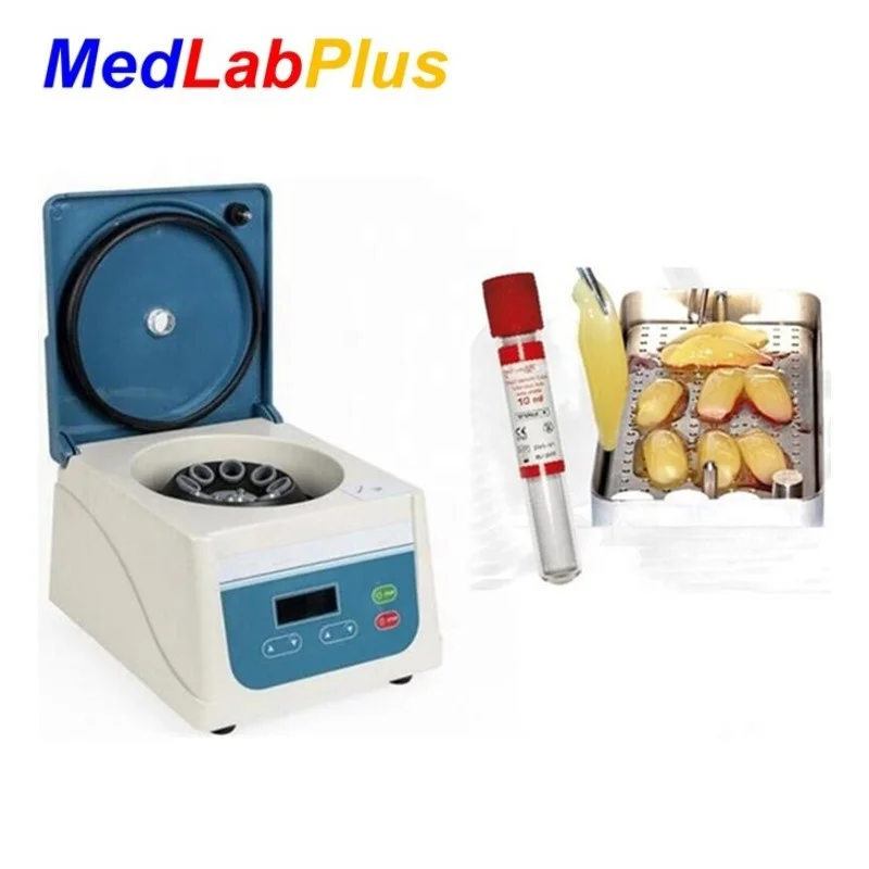 prf centrifuge dental