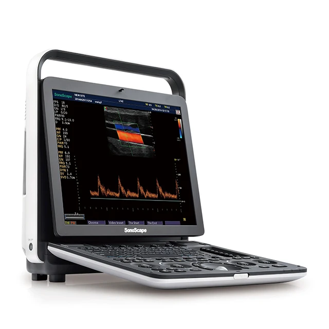 3/4D Real-time S9 Pro Portable Digital Color Doppler Ultrasound