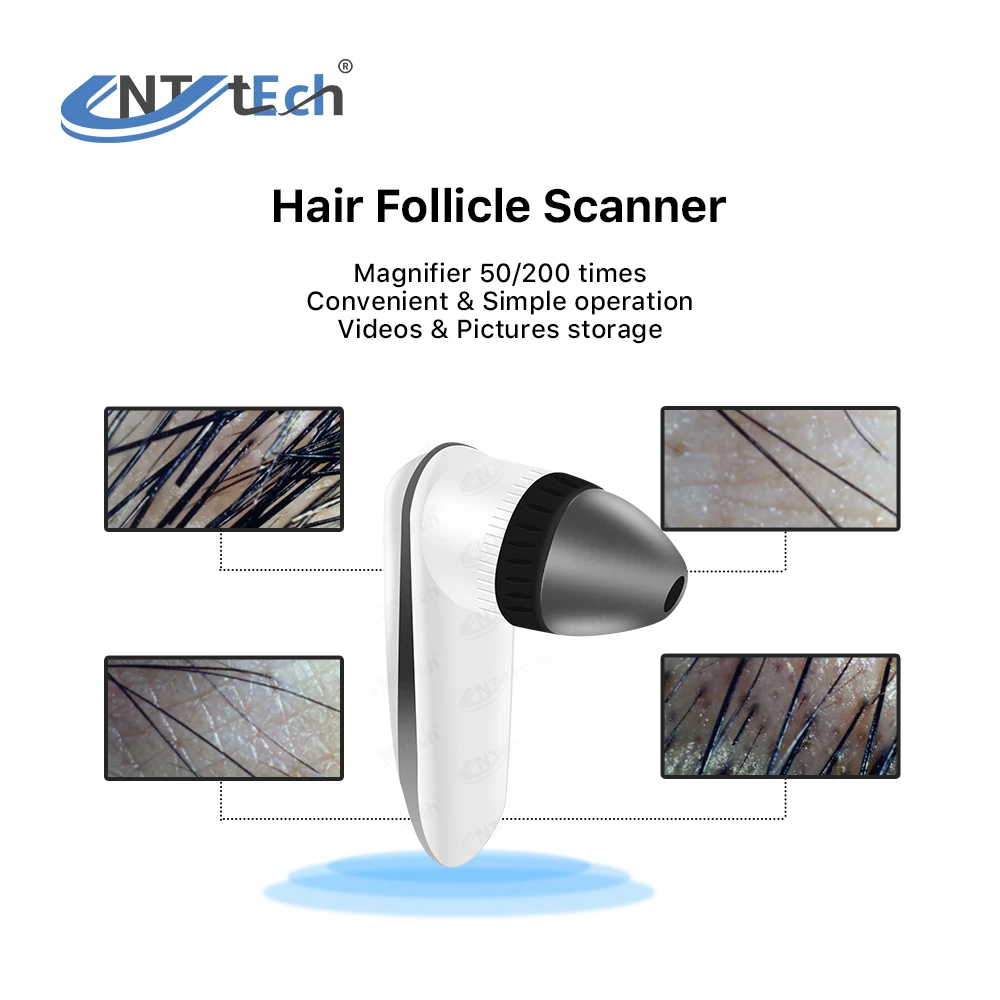 Hot selling 755nm 808nm 1064nm portable diode laser hair removal machine