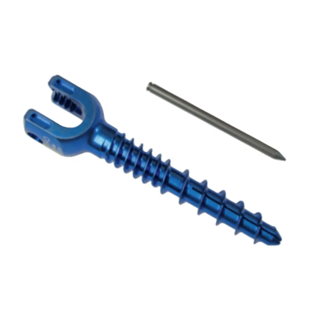 USS 5.5 Pedicle Screw Rod Orthopedic Implant Medical Implant Spine Implant for thoracic lumbar fixation