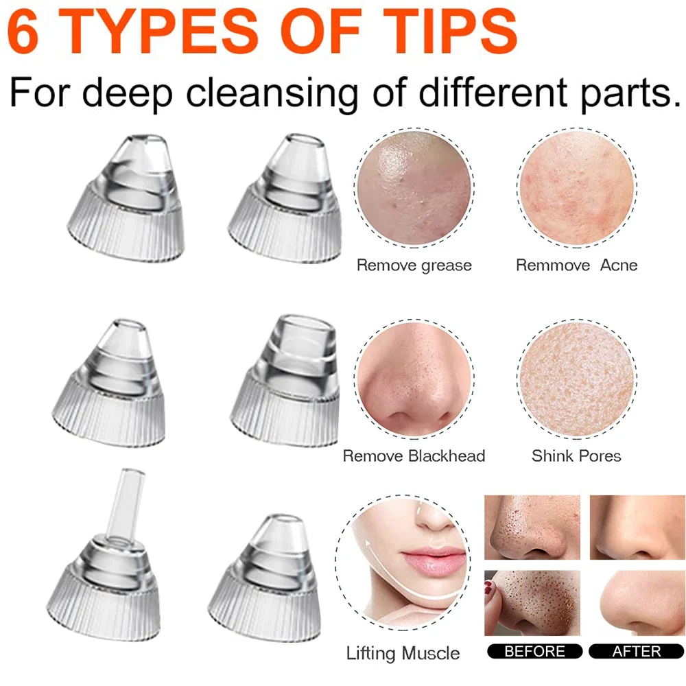 Blackhead Remover Pore Vacuum Camera Pore Cleaner Acne Remover Electric Heating Nose Face Deep Cleansing WIFI Microscope
