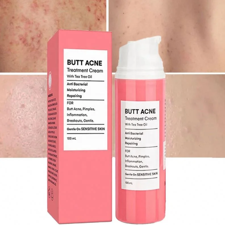 OEM/ODM Butt Cream Manufacturer Face Whitening Buttock Acne Mark Scar Supplier Body Bleaching Private Label butt acne cream