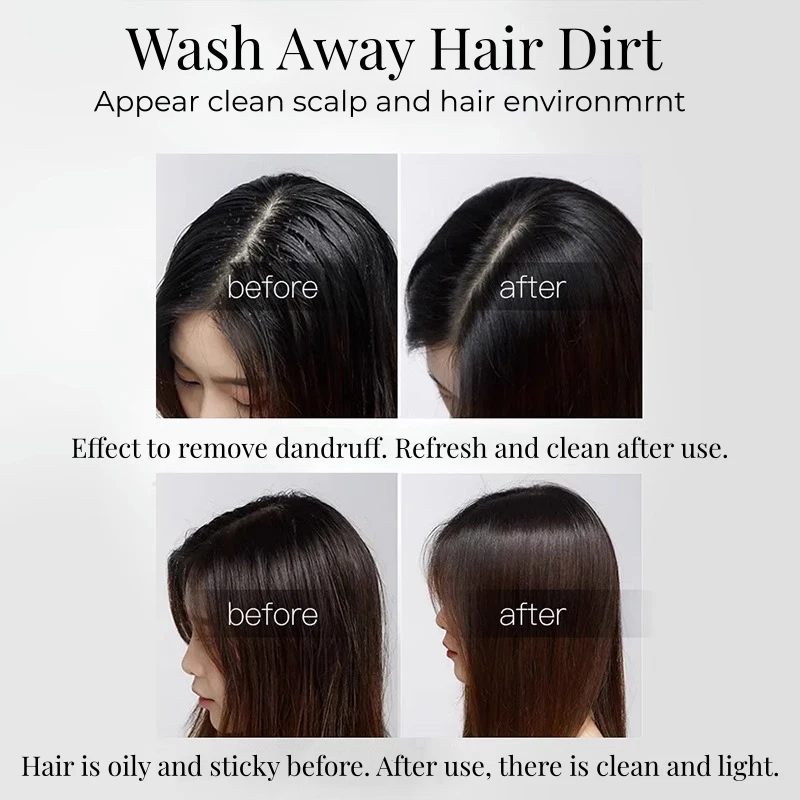 Sulfate Free Oily Scalp Anti Dandruff Shampoo Private Label Bio Plant Gentle Clean Shampoo