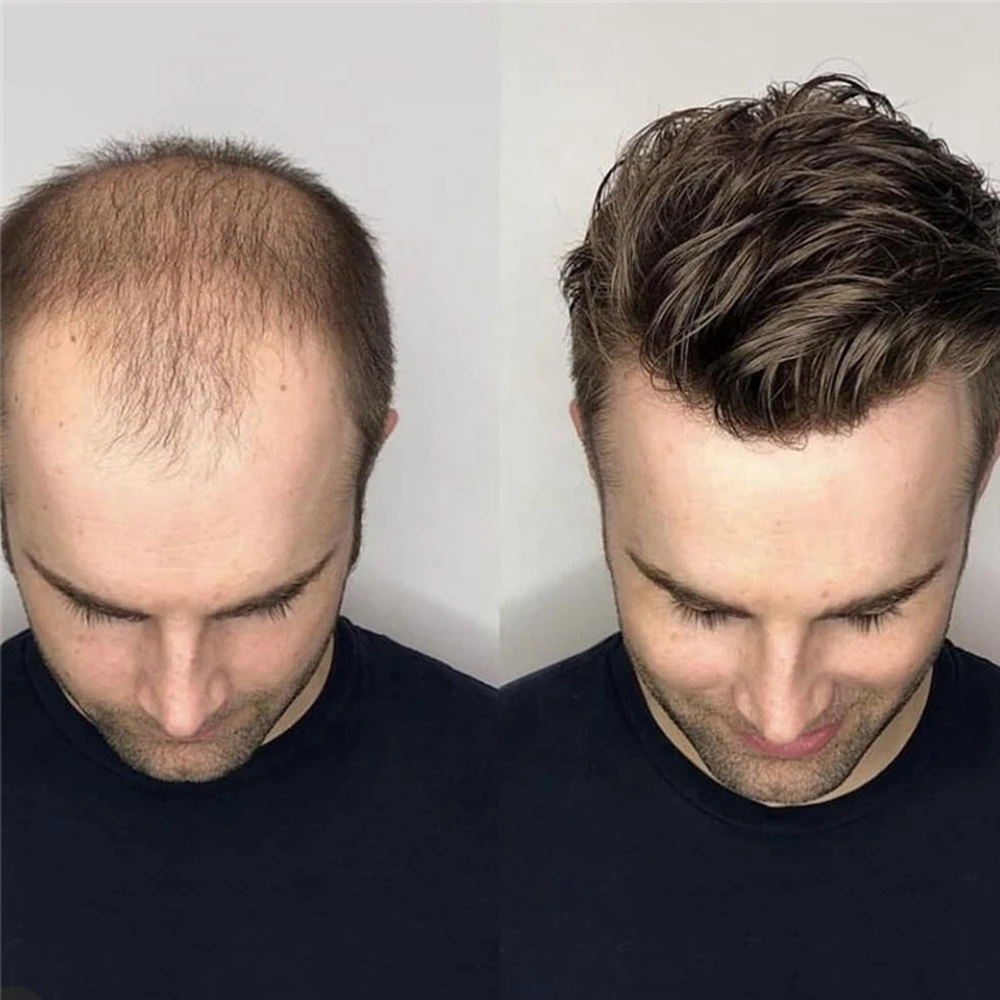 Kbeth Stock Good Quality Natural Hairline Man Wigs Hair System Natural 100% Human Hair Toupee For Men
