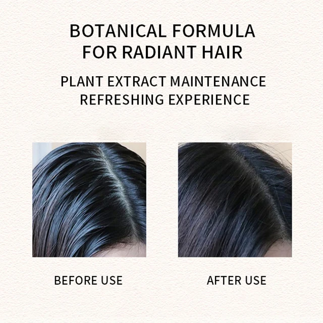 Private Label Custom Rosemary Fast Hair Growth Oil Natural Organics Mint Scalp & Hair Strengthening Oil