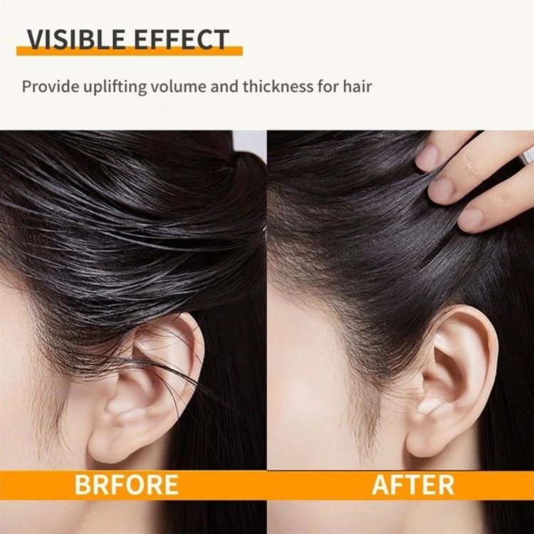 Private Label Plant Extract Herbal Anti Dandruff Hair Scalp Treatment Shampoo and Conditioner for Momen and Men