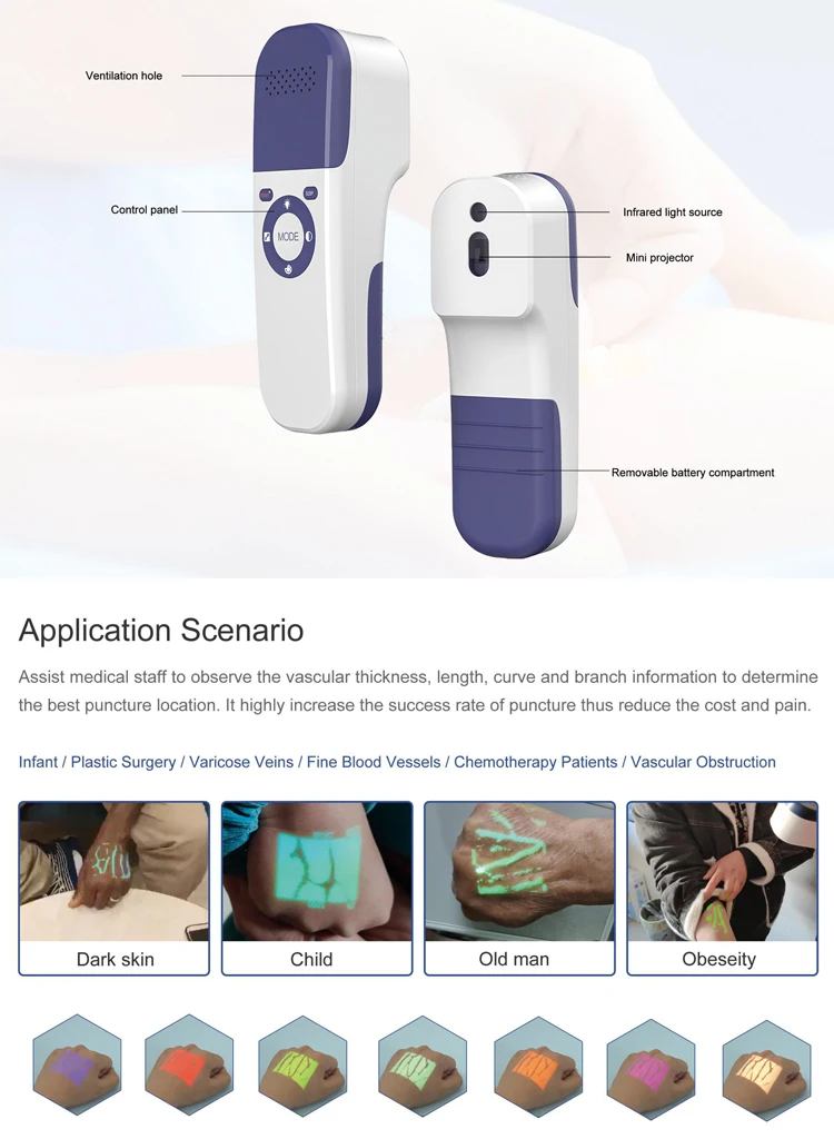 Newest Patient Vein display vein viewer medical portable hand hold vein illuminator infrared portable for finger Vascular