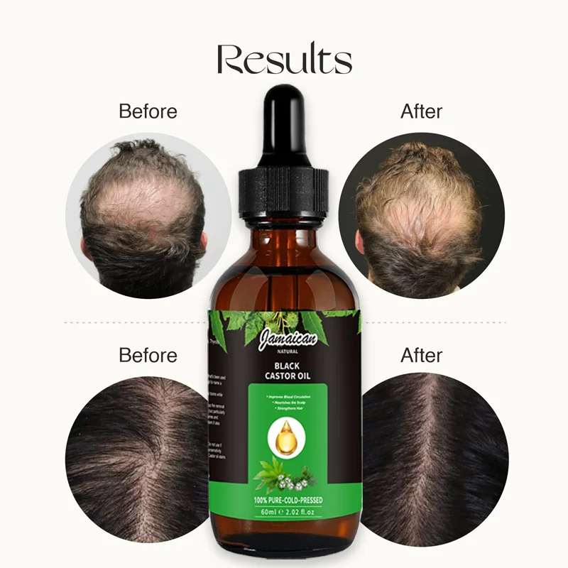 Latest Product Strength Scalp Natural Repair Castor Oil Jamaican Black Seed Caster Oil Deep Hair Treatment Care Organic Hair Oil