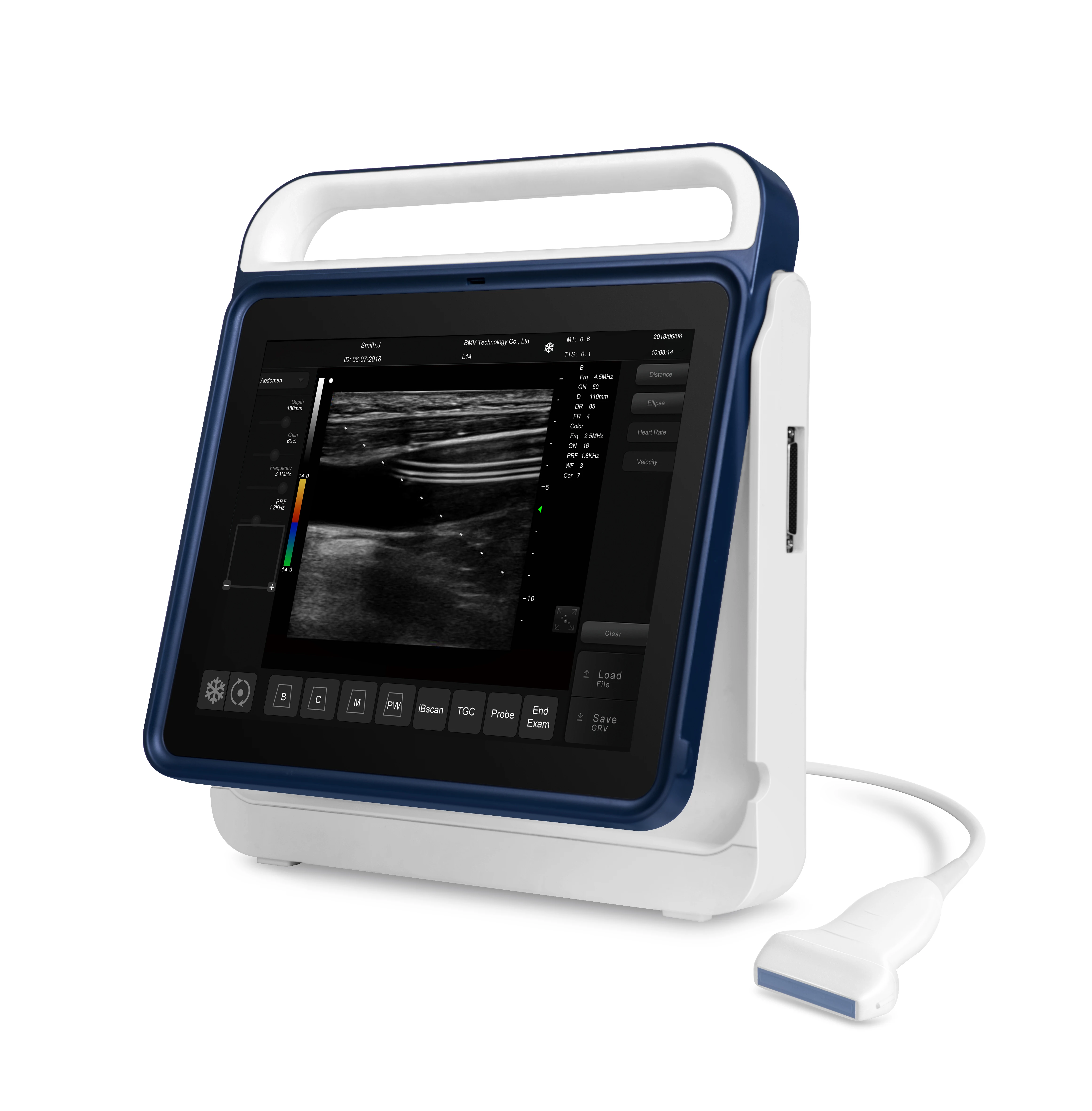 Medical Bovine Cattle Equine Ultrasound System Handheld Portable Ovum Pick-Up Veterinary Ultrasound Scanner