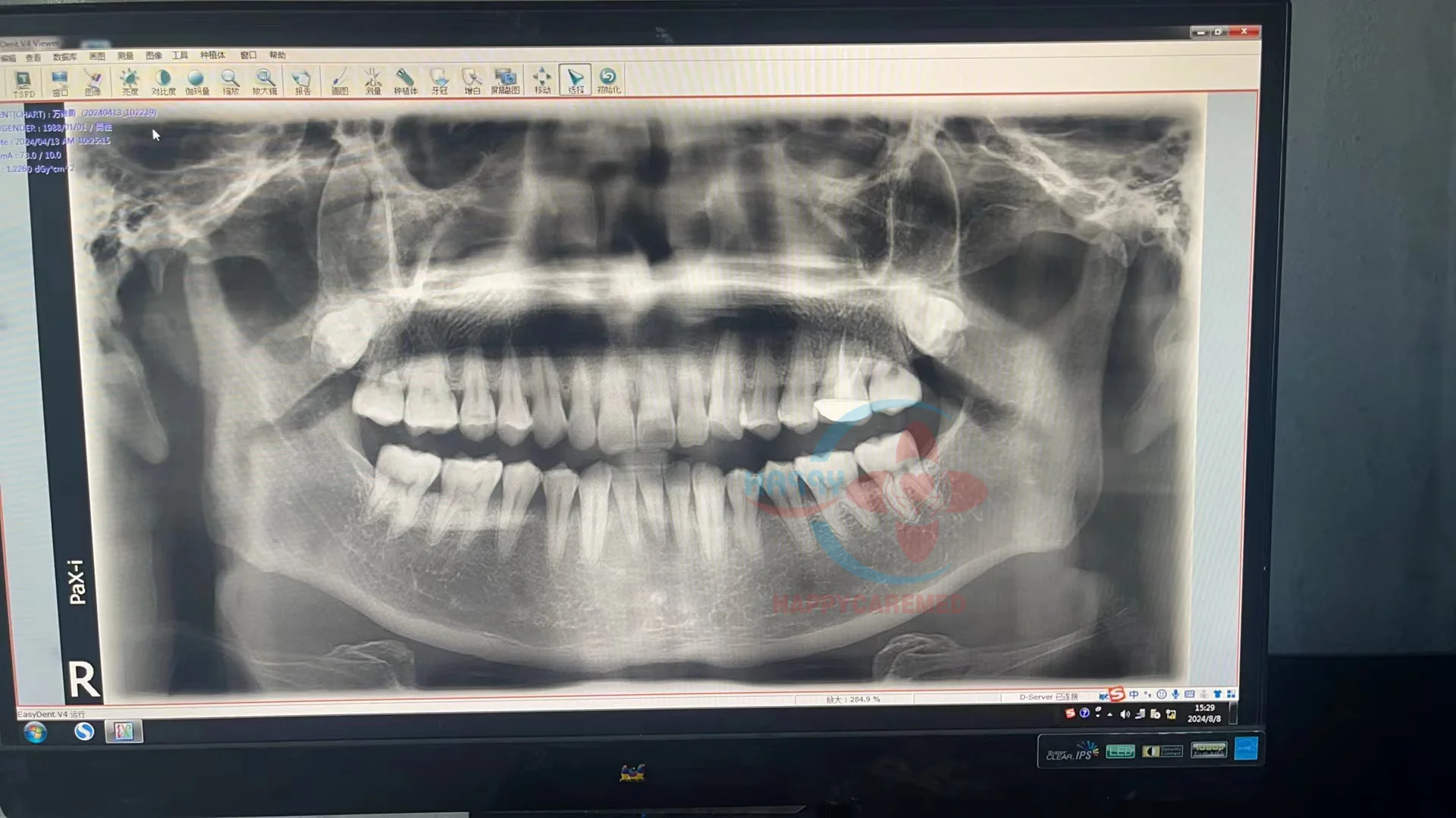 Used   Panoramic Dental  portable x ray machine