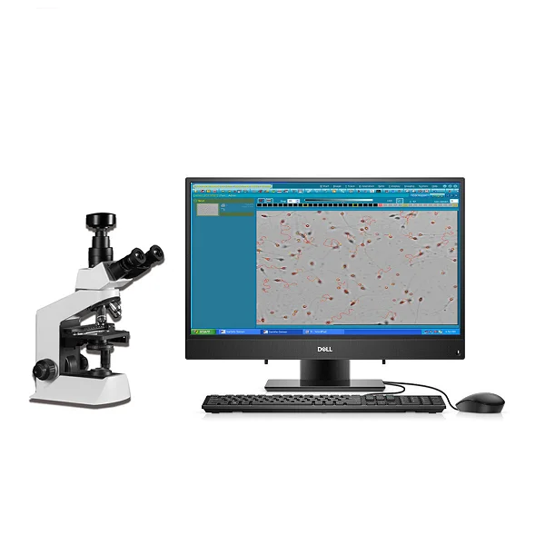 Top quality Sperm Analyzer price software for sperm concentration,motility and morphology