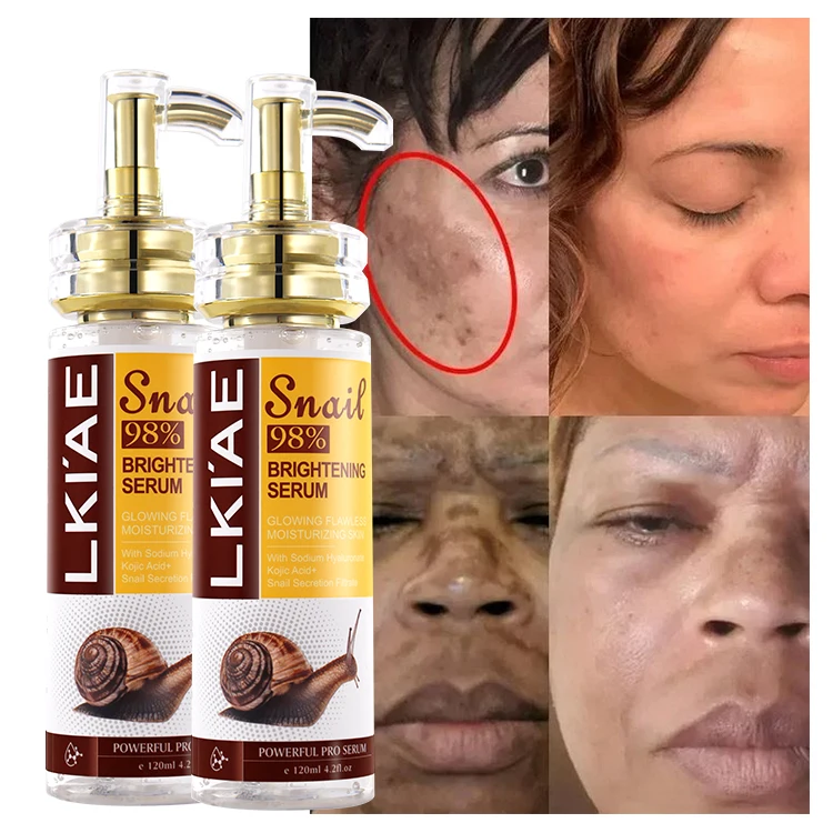 Private Label Snail secretion filtrate vitamin K smooth skin texture anti-redness resist aging facial serum