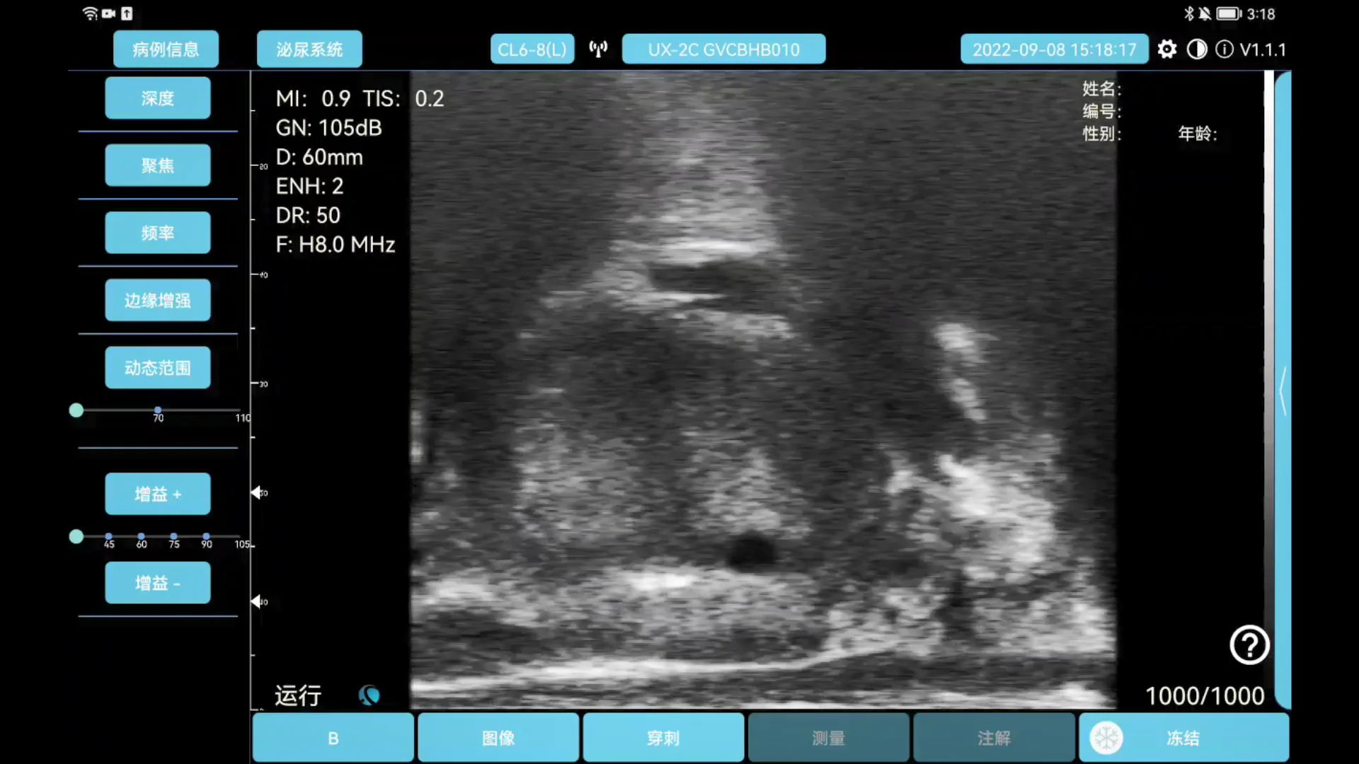 Highest quality transrectal colour doppler portable ecografo transducer micro convex linear wireless ultrasound probe