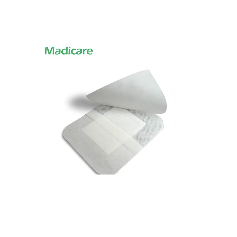 Альгинат перевязочные, медицинские нетканые туалетный коврик, стерильные медицинские нетканые перевязки pad
