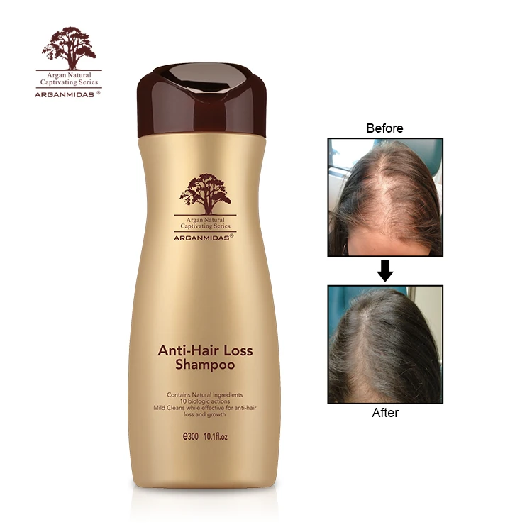 Hair Grow Up Products To Make Your Hair Growth Herbal Treatment Oil Growing Shampoo
