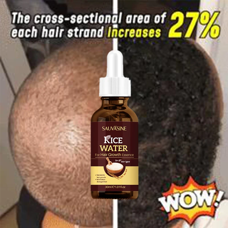 Private Label Hair Treatment Growth Serum Hair Loss Treatment Instant Rice Water Hair Growth Serum