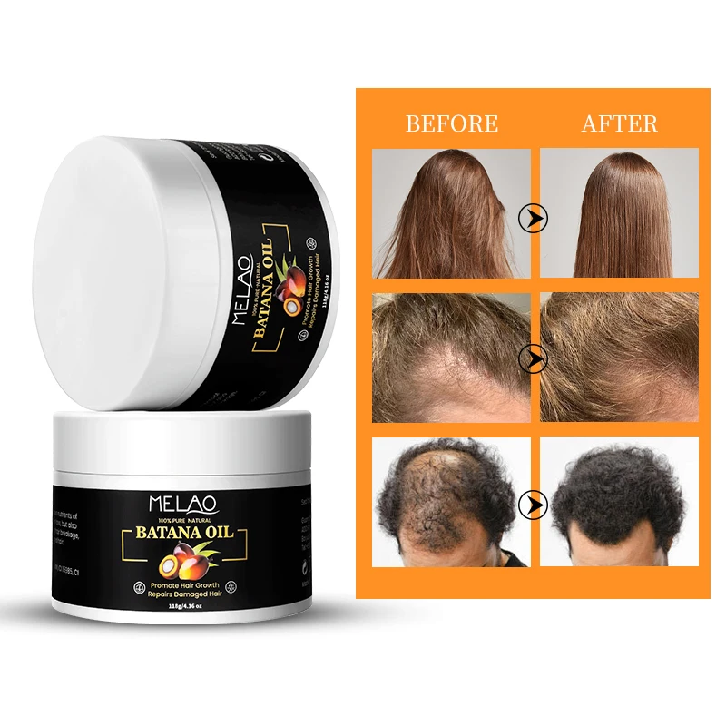 Private Label Melao Batana Oil Hair Mask Treatment Nourishing Detox Hair Care With Scalp Mask For Dandruff