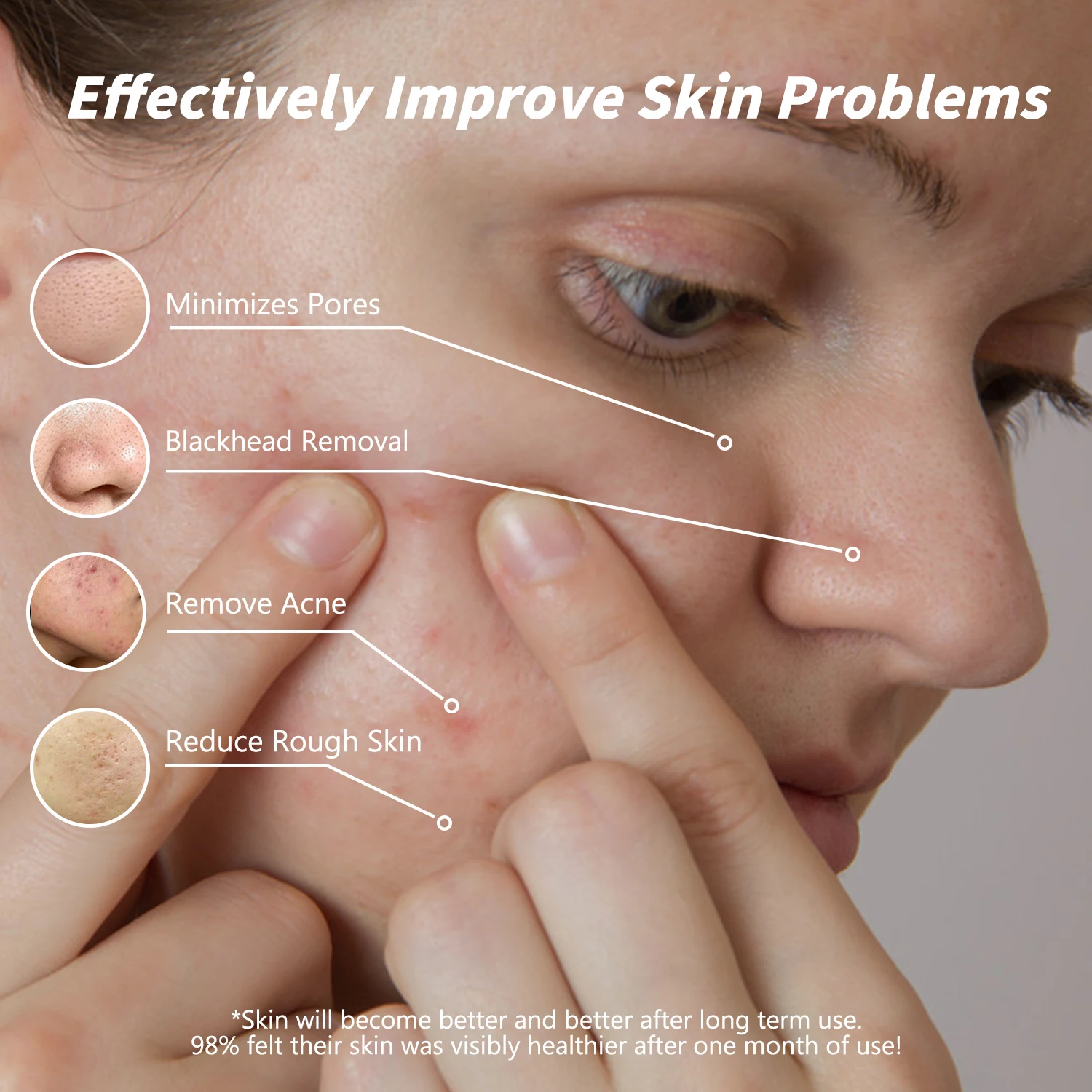 UNES Natural Anti-Pores Acne Whitening Clay Mud Facial Mask Deep Cleansing Face Mask Sensitive Hyaluronic Acid Chemical Nose