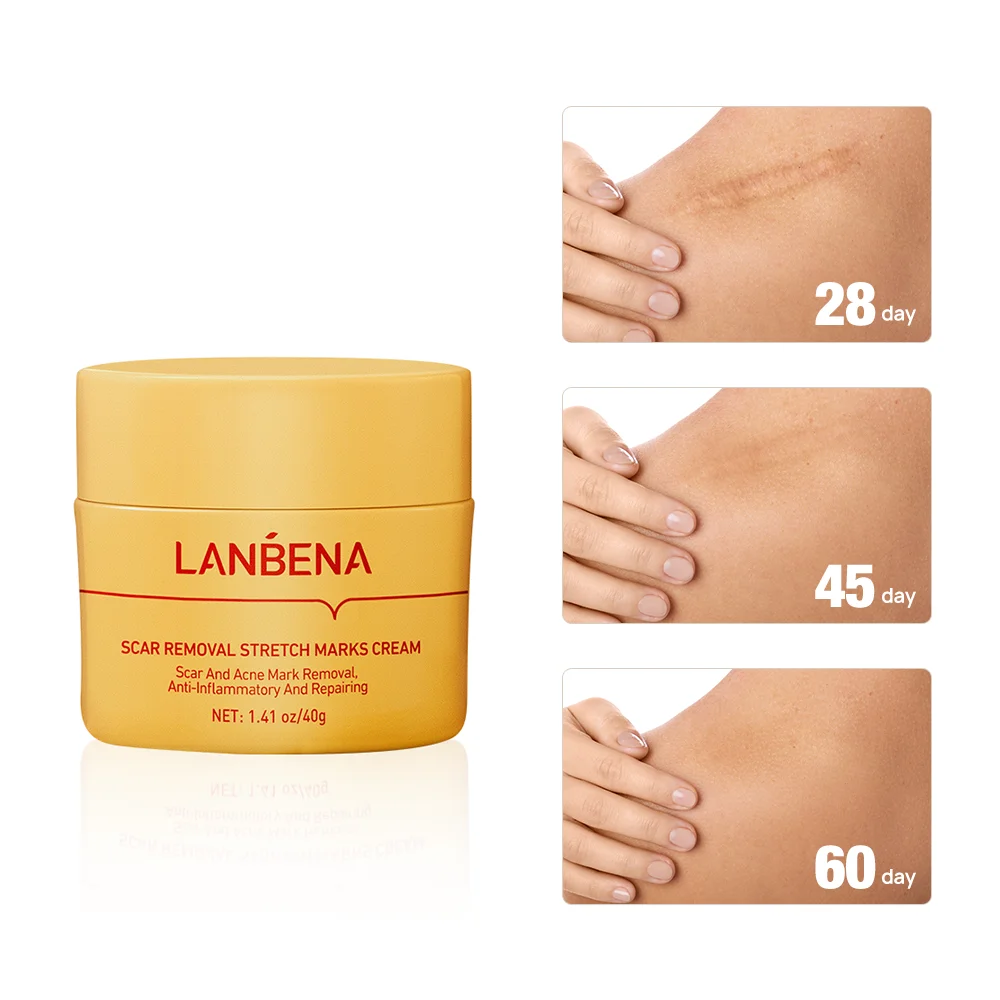 LANBENA TCM Scar Removal Cream Acne Treatment Repairing Scar Non irritating Whitening Cream Anti Winkles Moisturizing Skin Care