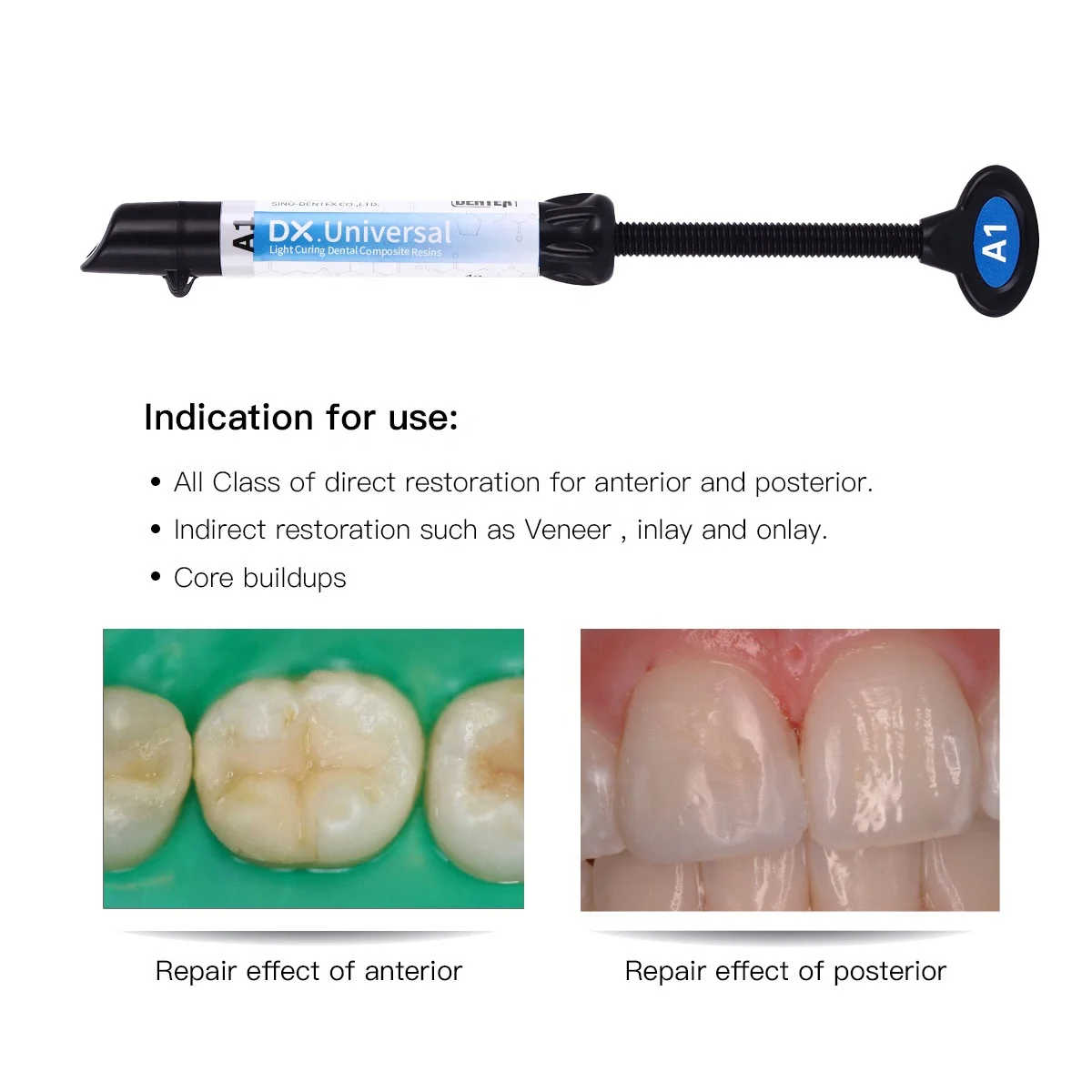 High Quality 4g/box Dental Filling Composite Universal light Curing Resin