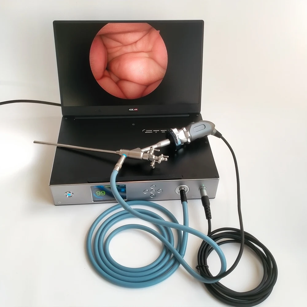 Camjoy Full HD 1080P ENT Portable Endoscopy Camera With 4K Display